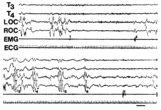 [Figure 3: WILD]